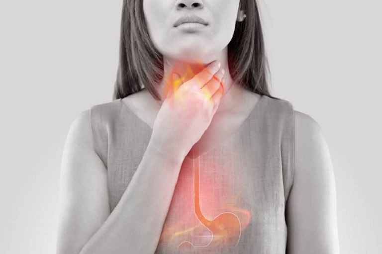 Trào ngược dạ dày là một trong những nguyên nhân gây viêm họng hạt mãn tính