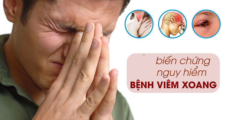 Biến chứng viêm xoang có thể xảy ra ở mắt, não, xương, đường hô hấp
