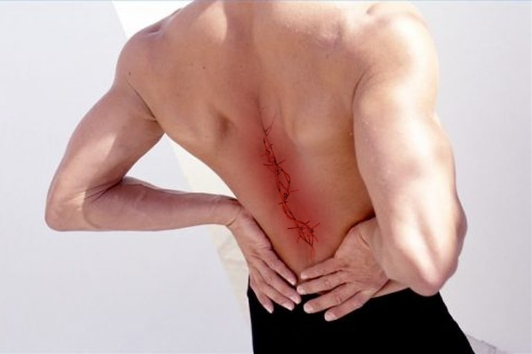 Những cơn đau thắt lưng, đau lan sang bên mạn sườn hay tê tứ chi là những dấu hiệu dễ thấy nhất của bệnh