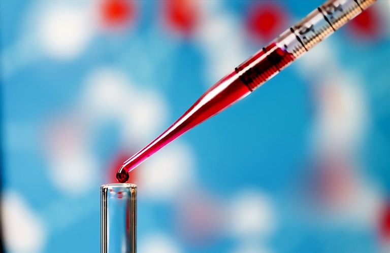 Xét nghiệm máu giúp xác định mức độ viêm nhiễm của bệnh