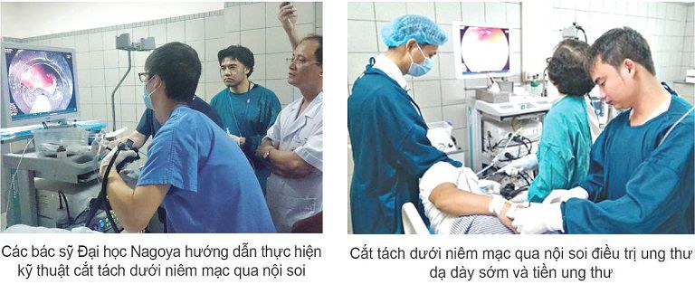 Khoa Tiêu hóa bệnh viện Bạch Mai có sự hợp tác với Nhật Bản trong khám chữa bệnh dạ dày